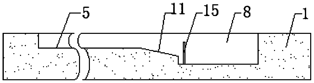 Quantitative detection kit for Sflt-1