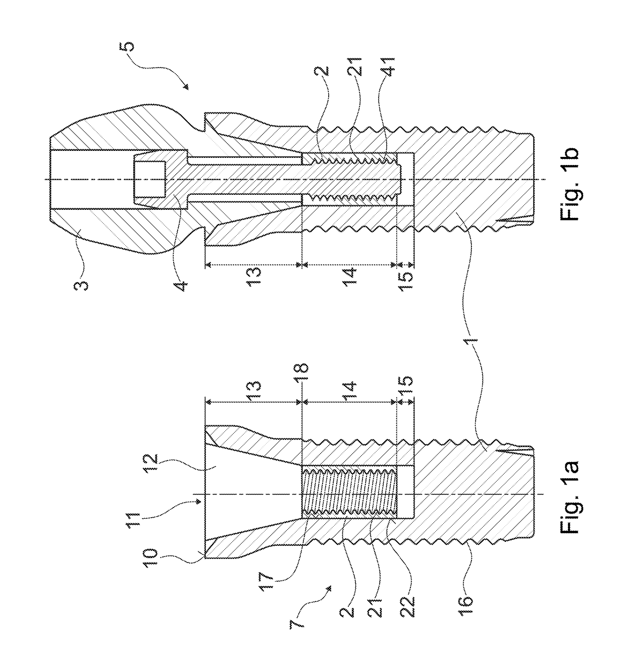 Dental implant system with ceramic implant