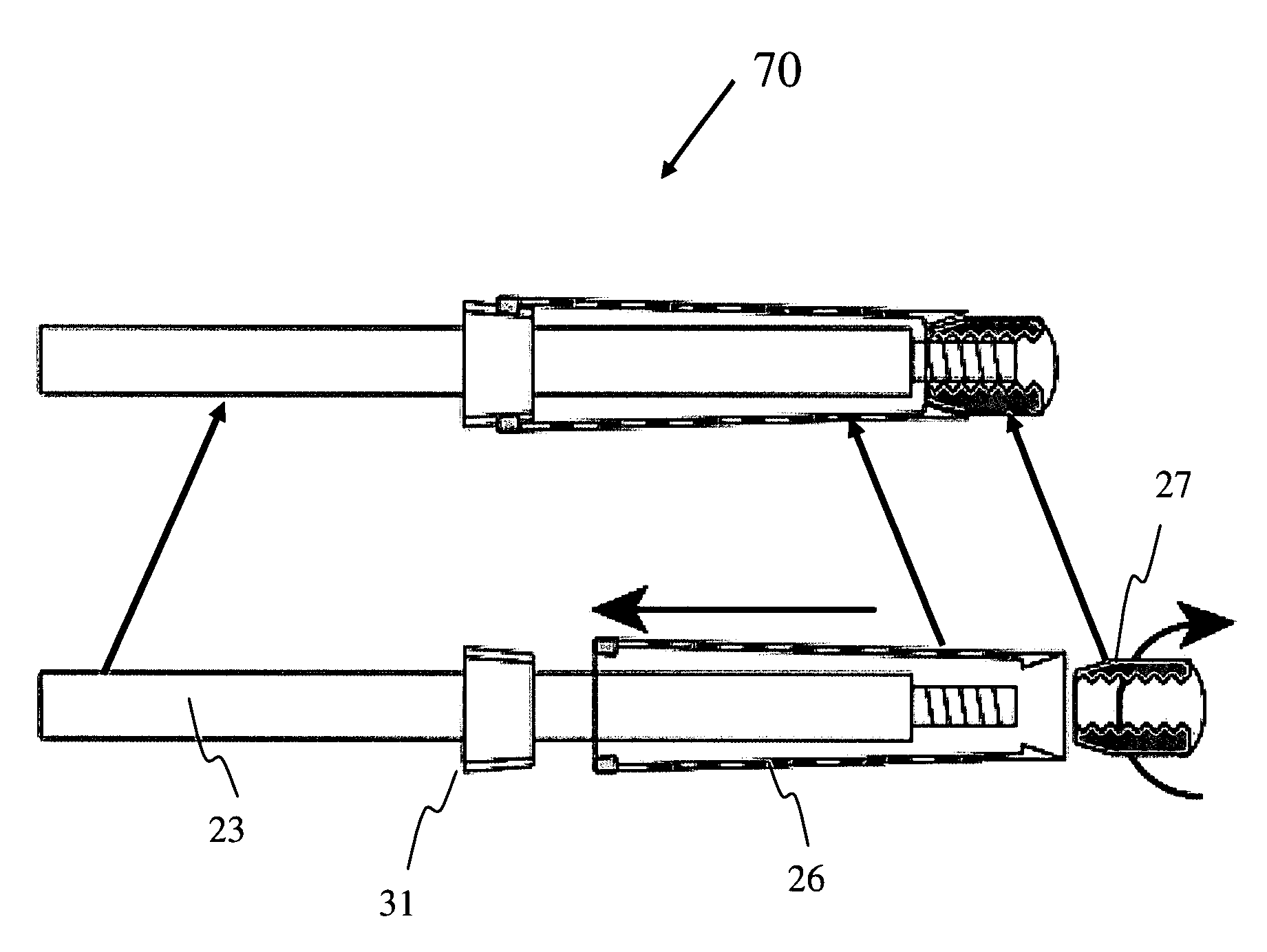 Modular tapered hollow reamer for medical applications