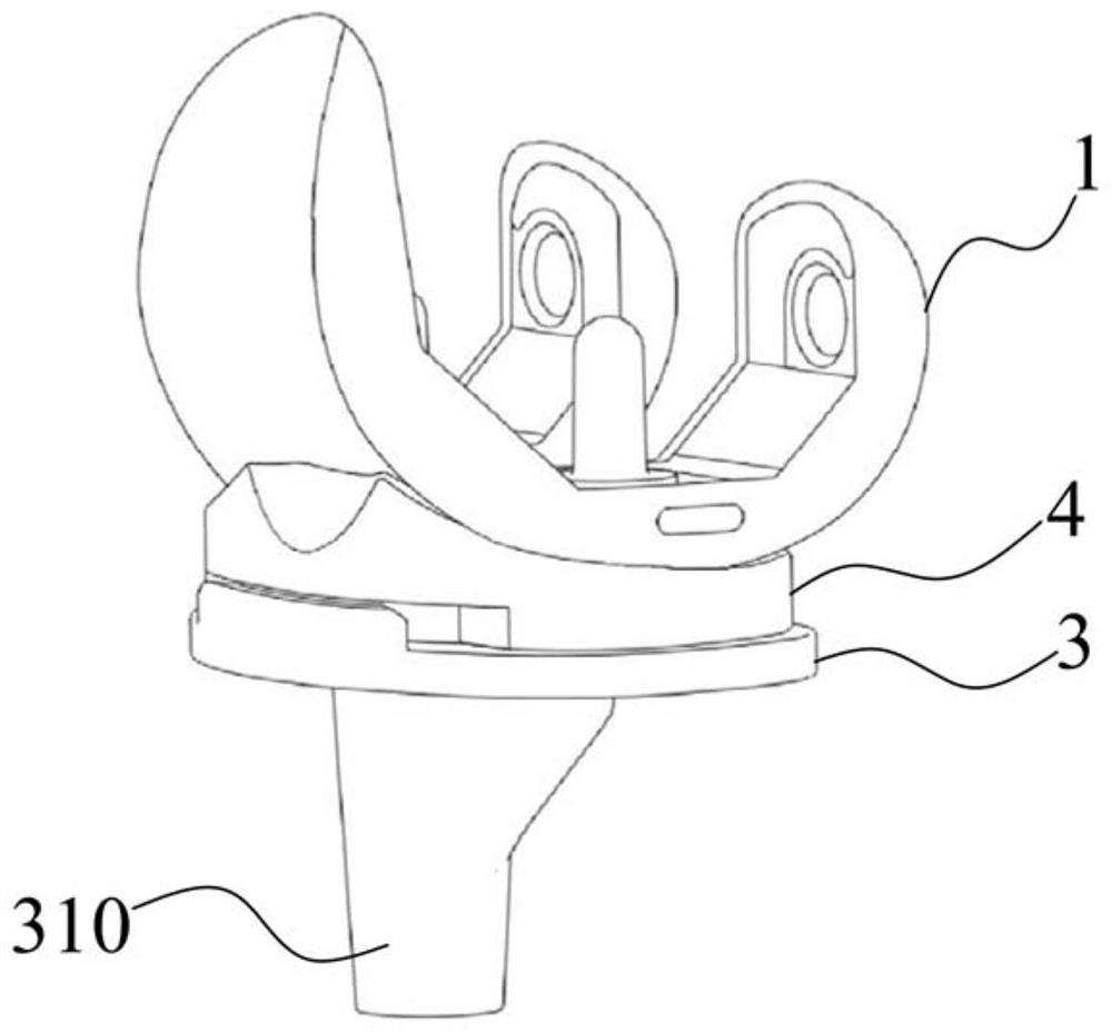 Tibial plateau, movable plateau liner, fixed plateau liner and prosthesis system for primary total knee replacement