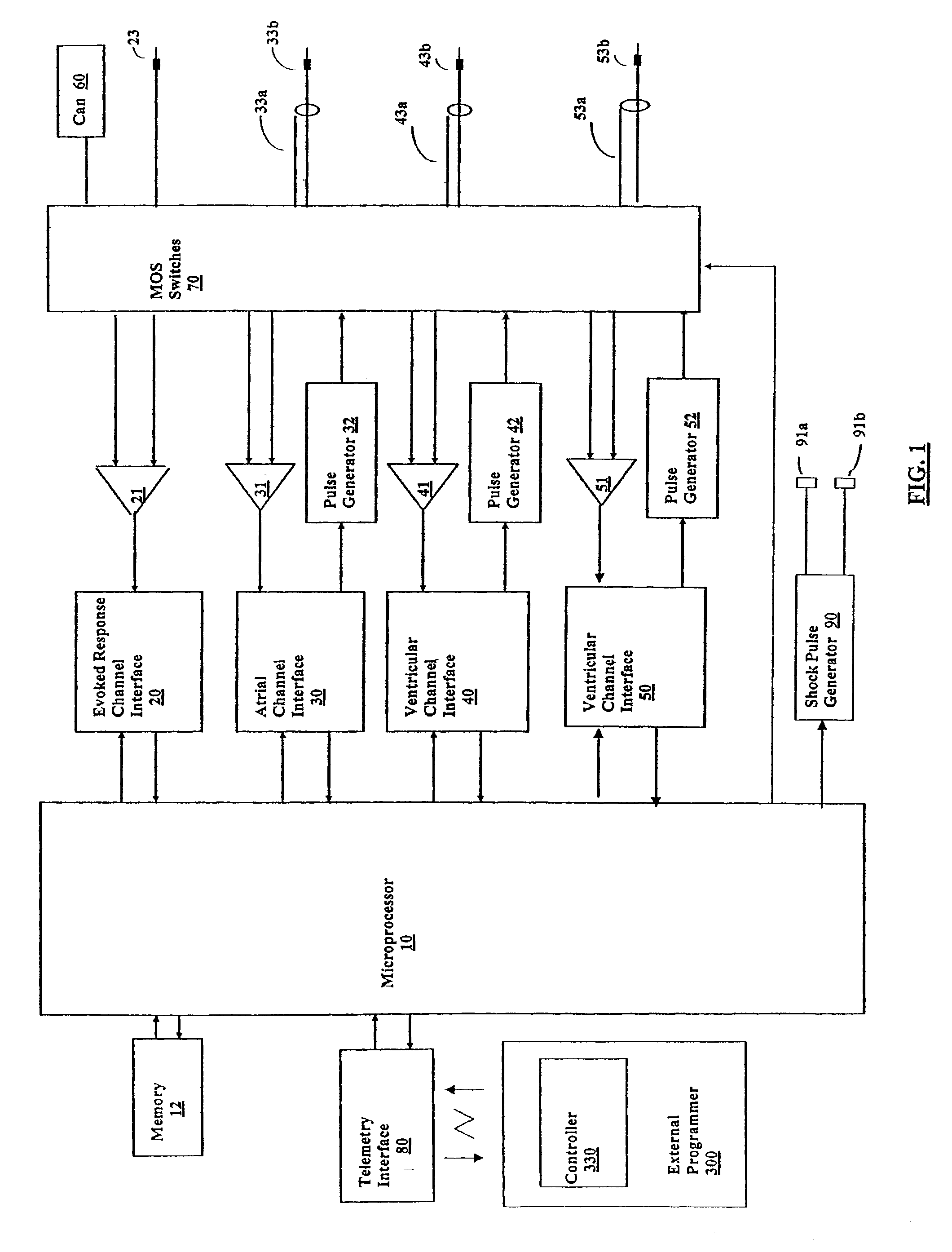 Template-based capture verification for multi-site pacing