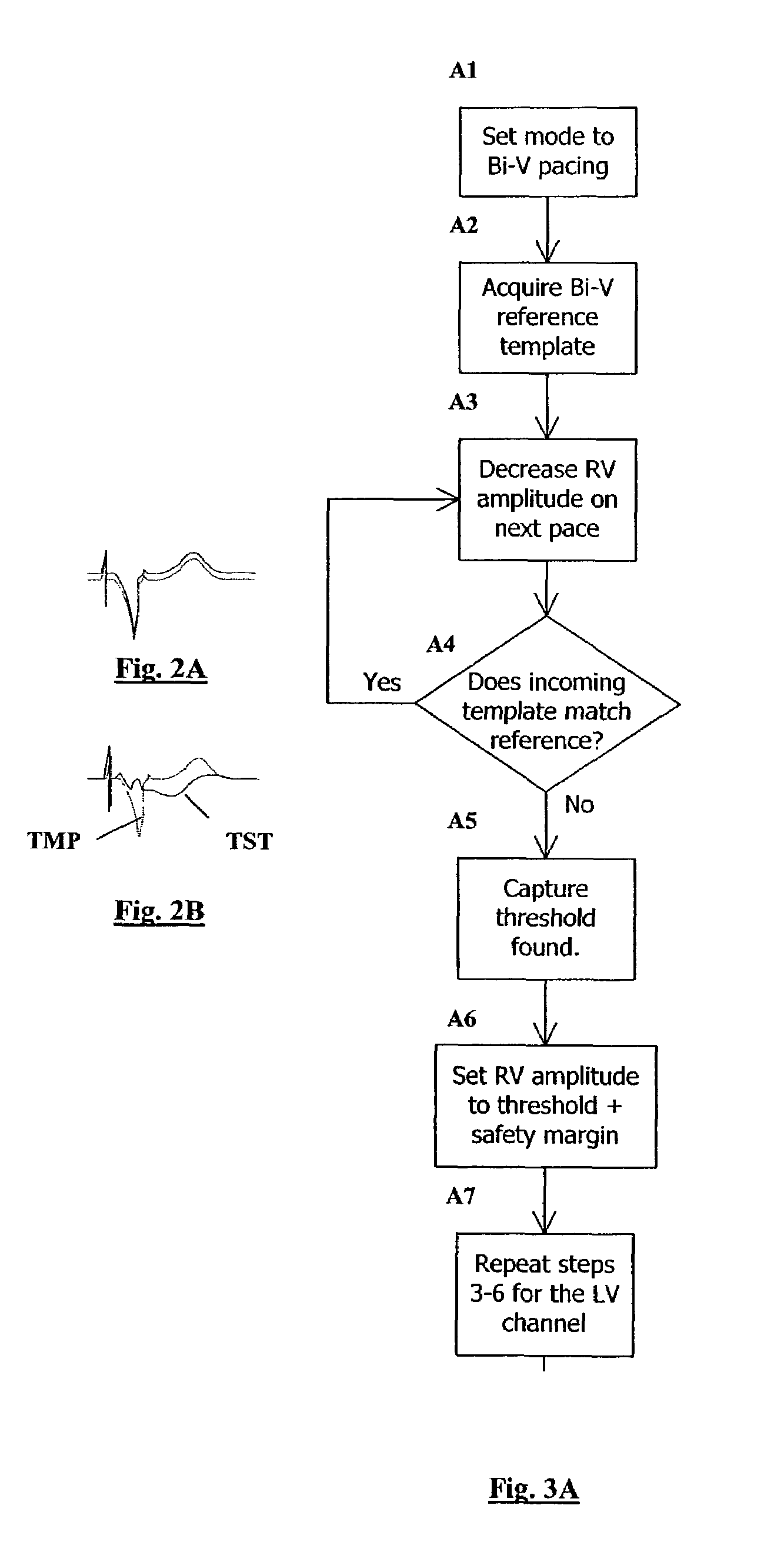 Template-based capture verification for multi-site pacing