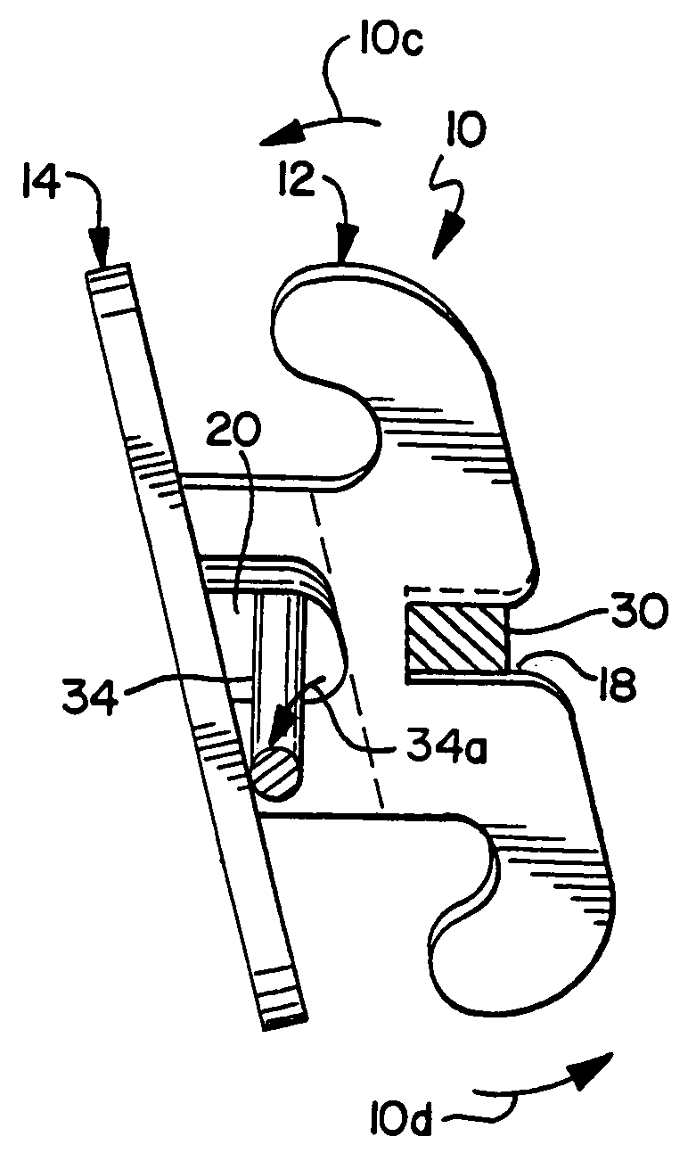 Edgewise orthodontic bracket for capturing lost torque