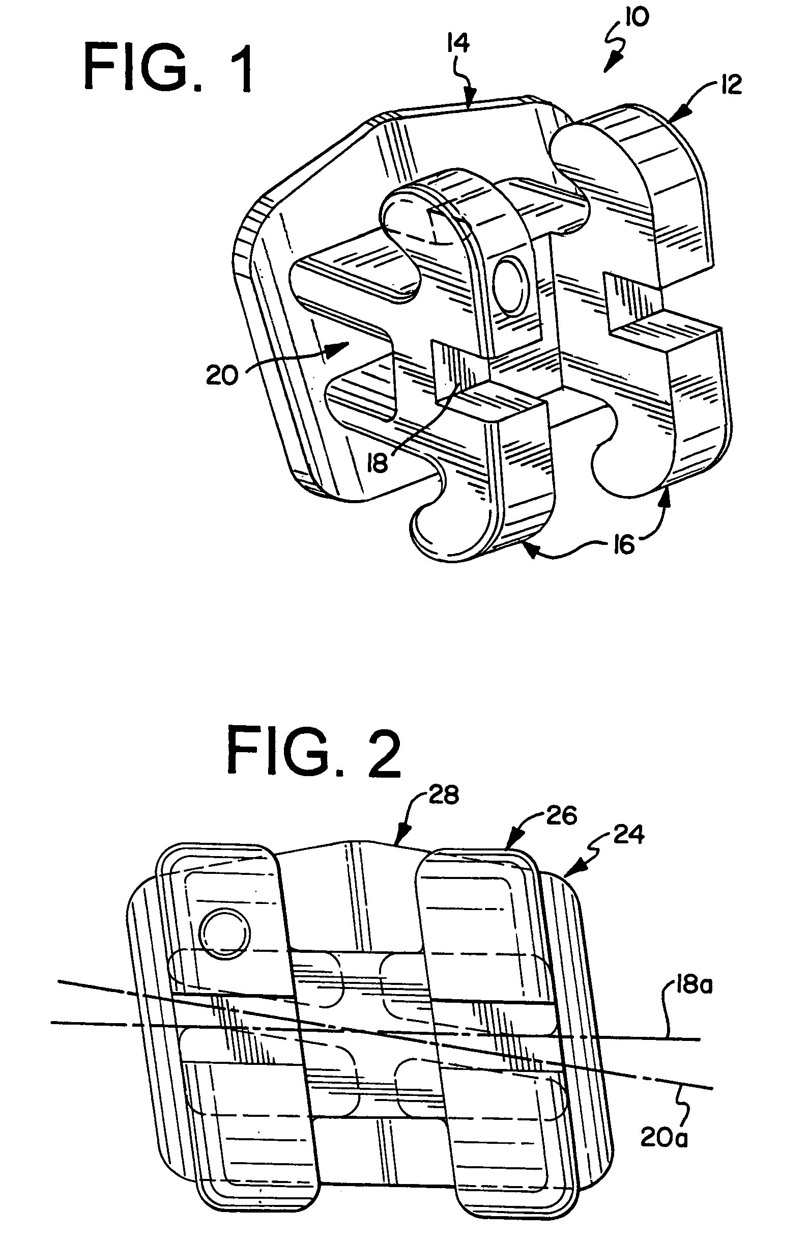 Edgewise orthodontic bracket for capturing lost torque