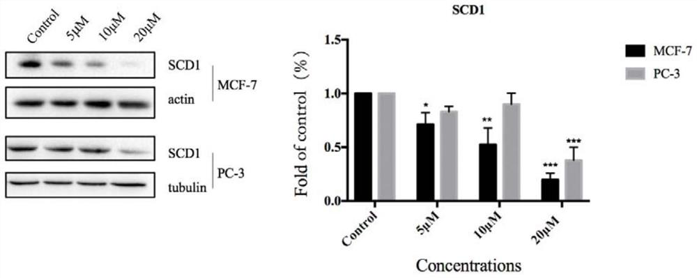 Medicine for inhibiting stearoyl-CoA desaturase 1