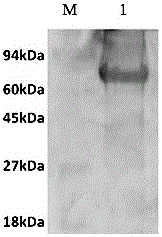 Toxoplasma gondii tandem multi-epitope gene ELISA detection kit