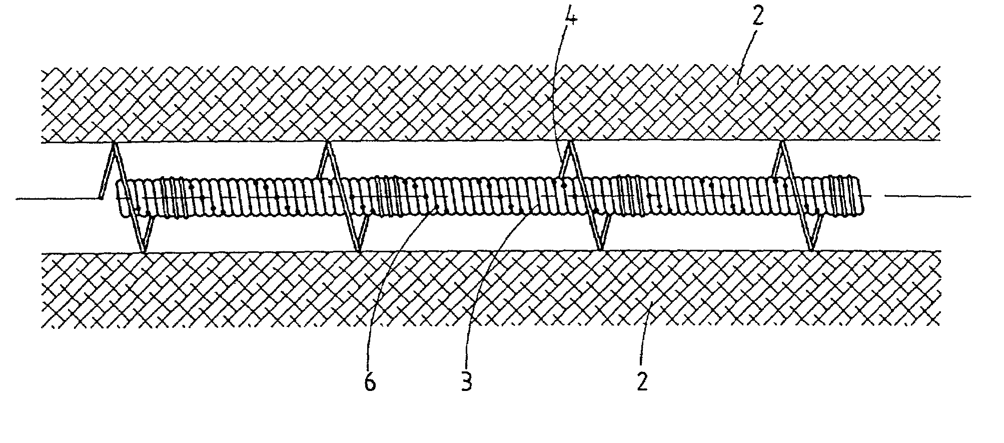 Intravascular dilatation implant with a deflector