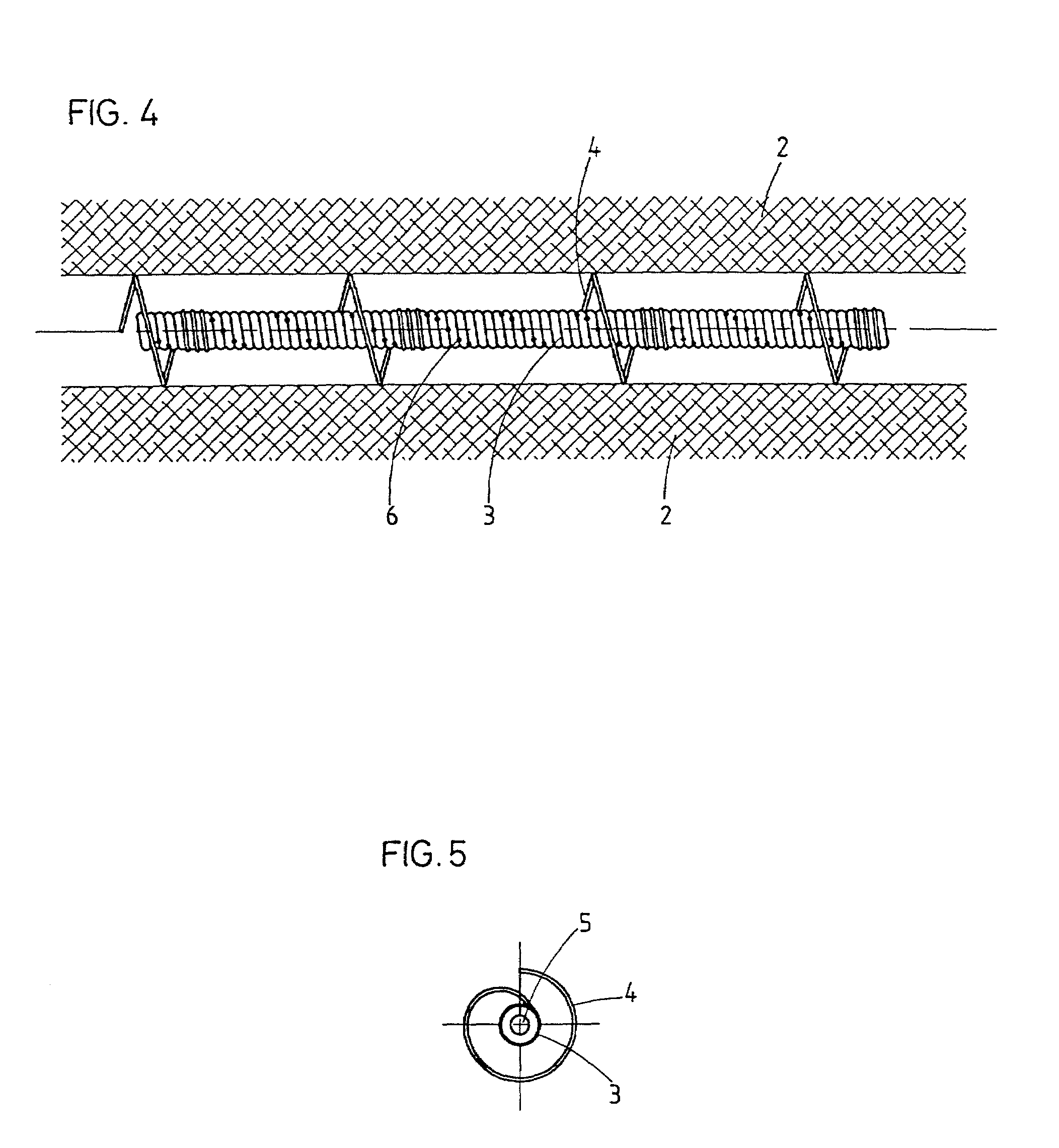 Intravascular dilatation implant with a deflector