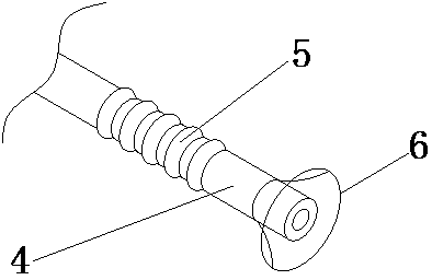 Repairing device of antique building aluminum part