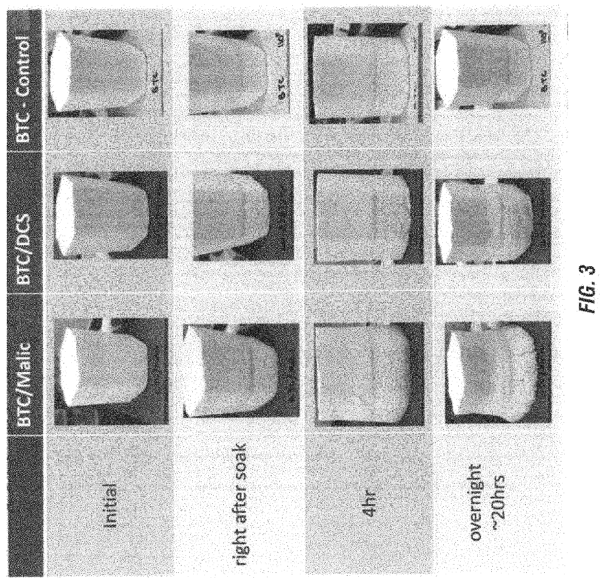 Mechanism of urea/solid acid interaction under storage conditions and storage stable solid compositions comprising urea and acid