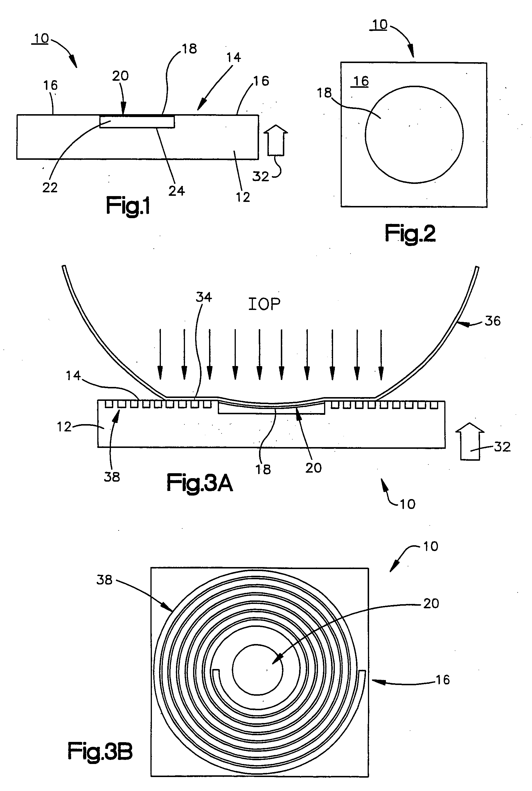 Intraocular pressure measurement system including a sensor mounted in a contact lens