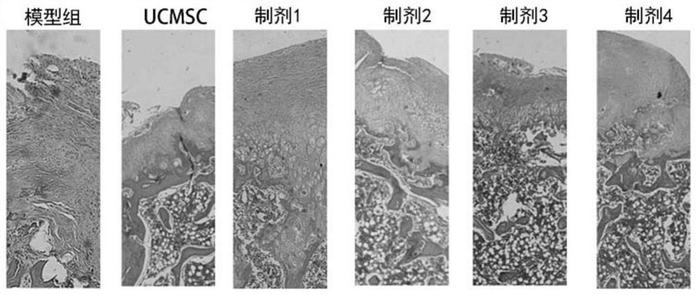 Application of umbilical cord stem cell preparation in preparation of medicine for treating osteoarthritis