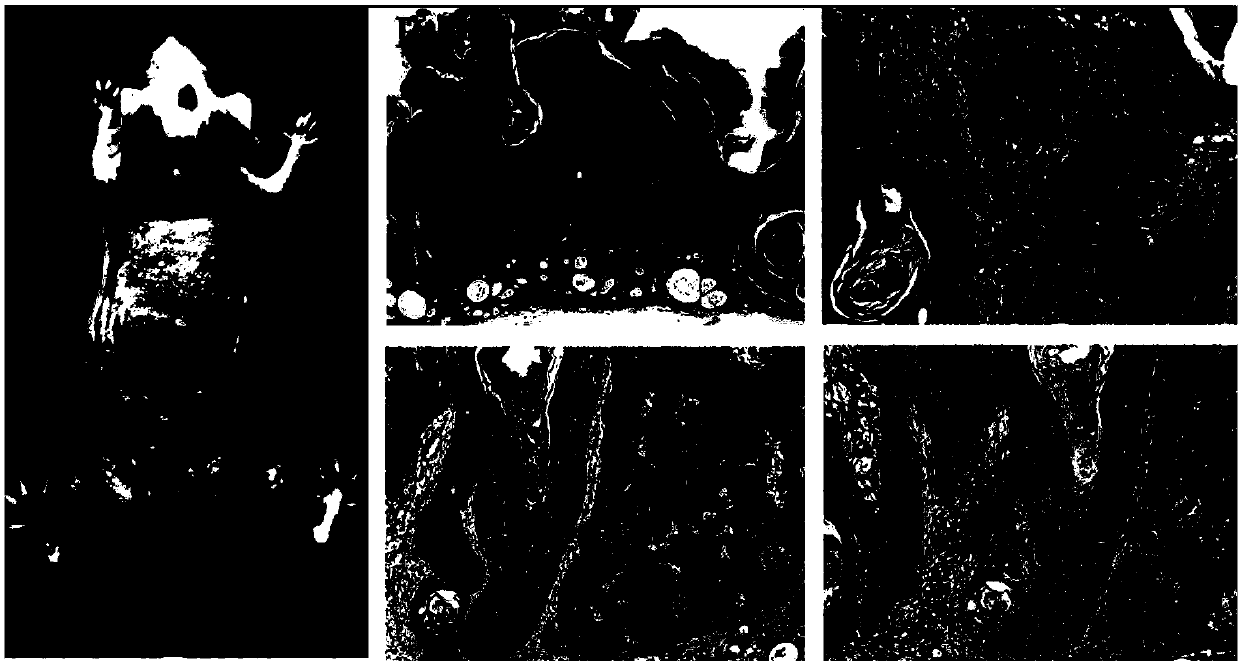 SKH-1 mouse skin squamous carcinoma cell line and application thereof in preparation of transplanted tumor model