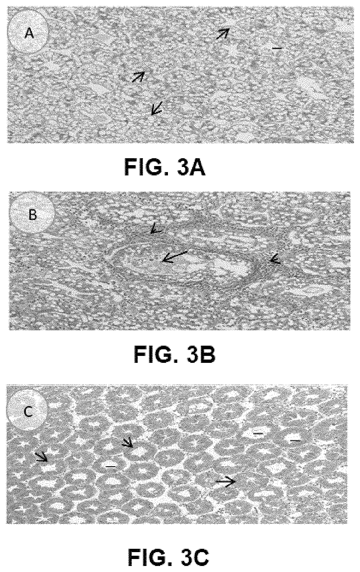 Synergistic dietary supplement compositions of <i>Sphaeranthus indicus </i>and <i>Terminalia chebula </i>for liver health