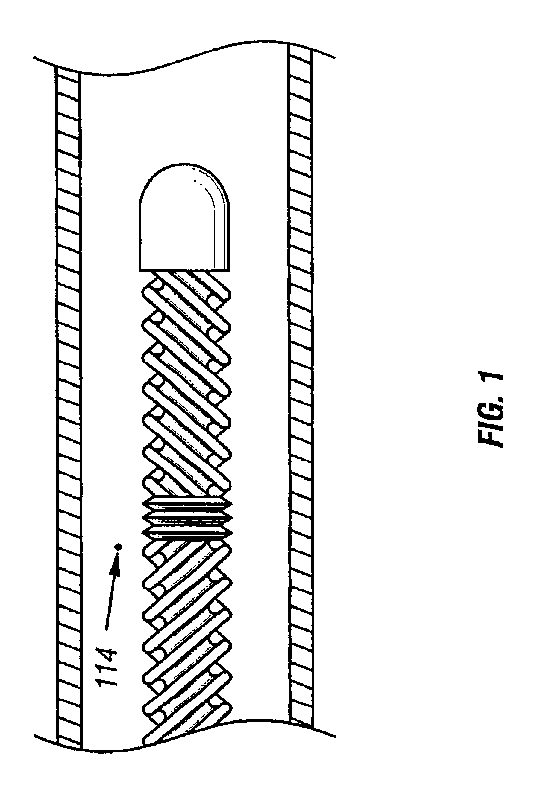 Method for low temperature thrombolysis and low temperature thrombolytic agent with selective organ temperature control