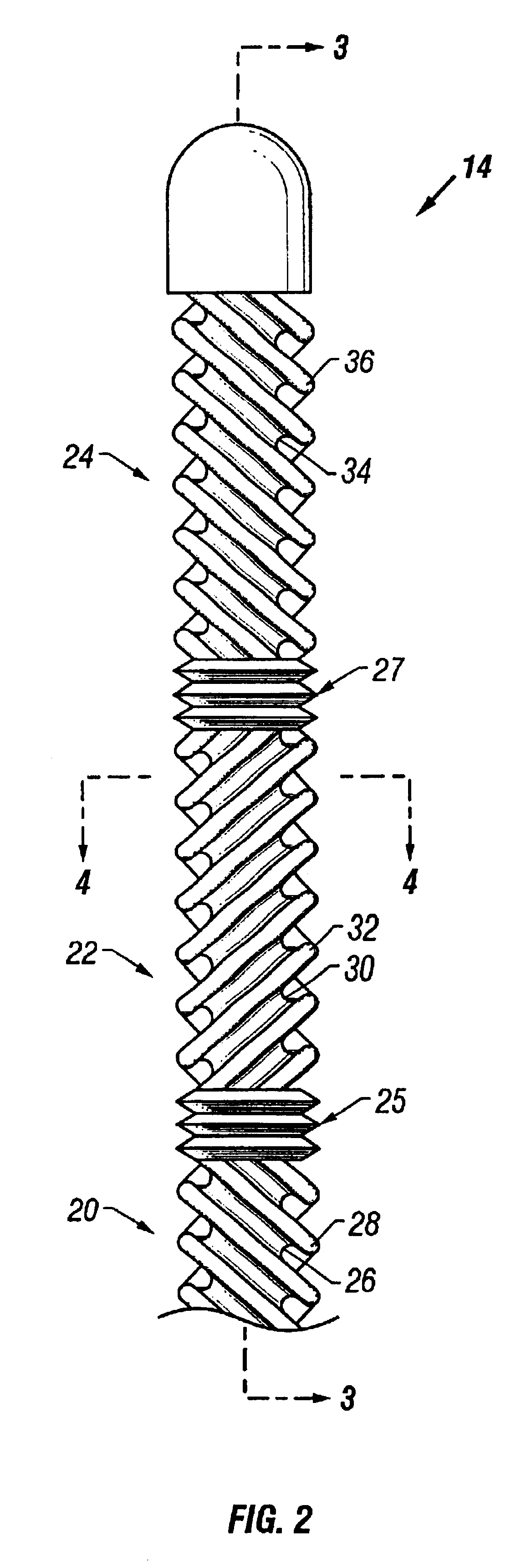 Method for low temperature thrombolysis and low temperature thrombolytic agent with selective organ temperature control