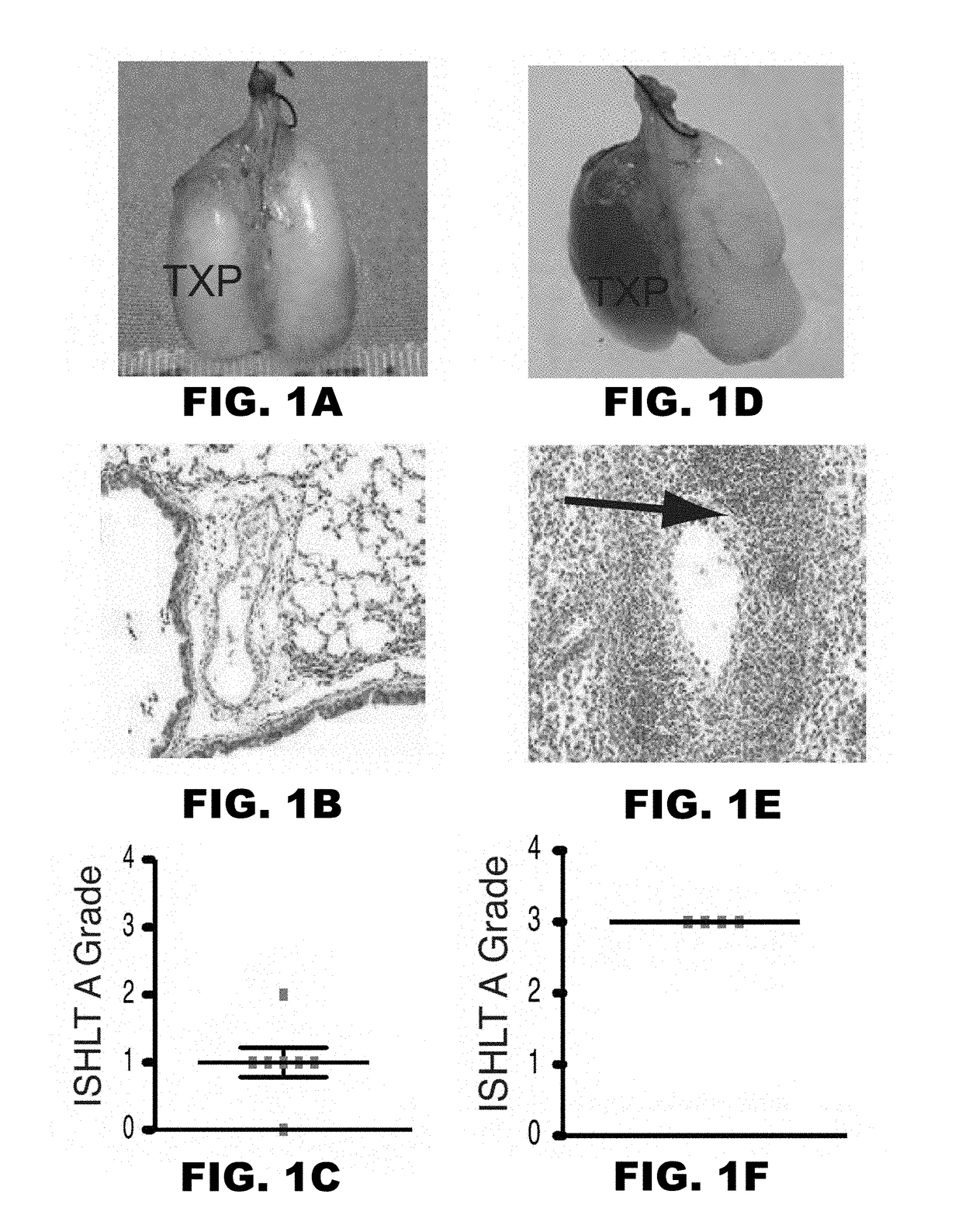 Induction of tolerance in lung allograft transplantation