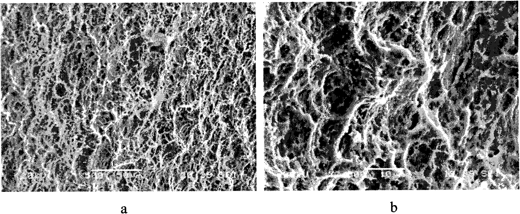 Dental implant of surface nano-structure and manufacturing method thereof