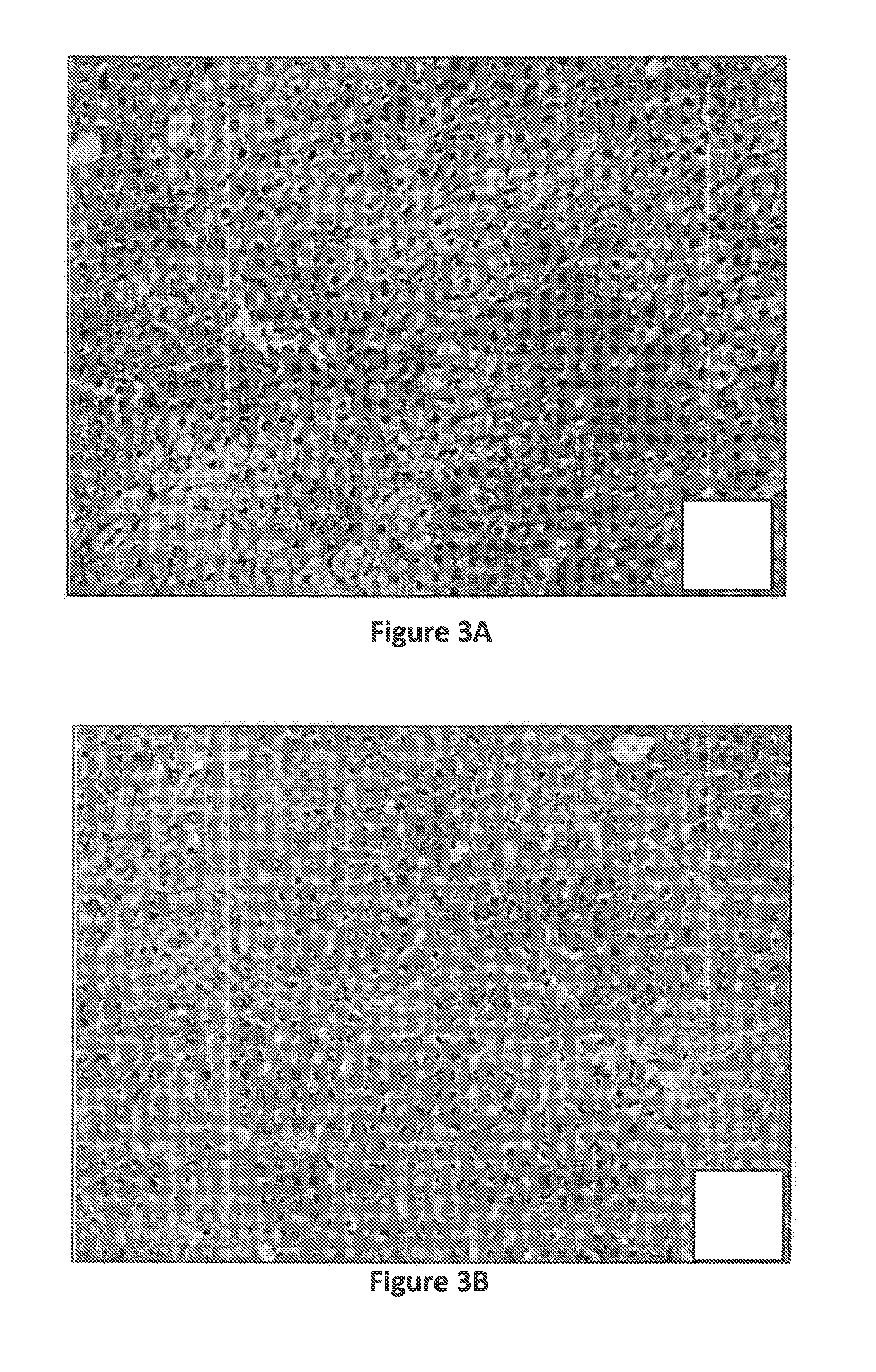 Compositions and Methods for Treating Cytokine-Related Disorders