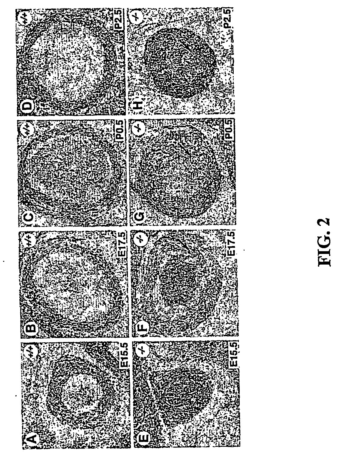 Elastin prevents occlusion of body vessels by vascular smooth muscle cells