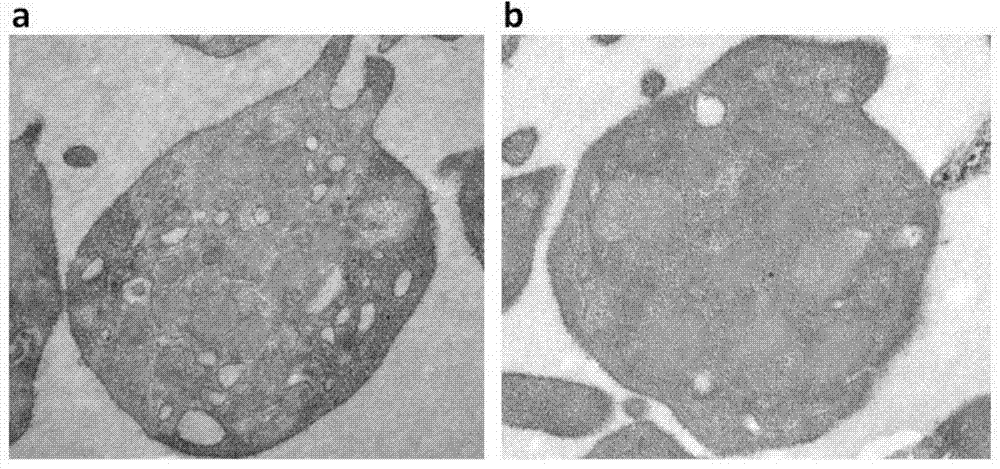 Novel platelet freeze-drying treating fluid