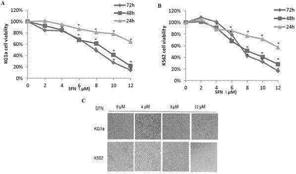 Application of SFN (sulforaphane) to preparation of medicine for treating leukemia