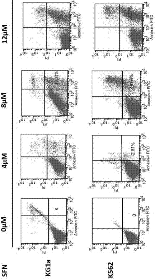 Application of SFN (sulforaphane) to preparation of medicine for treating leukemia