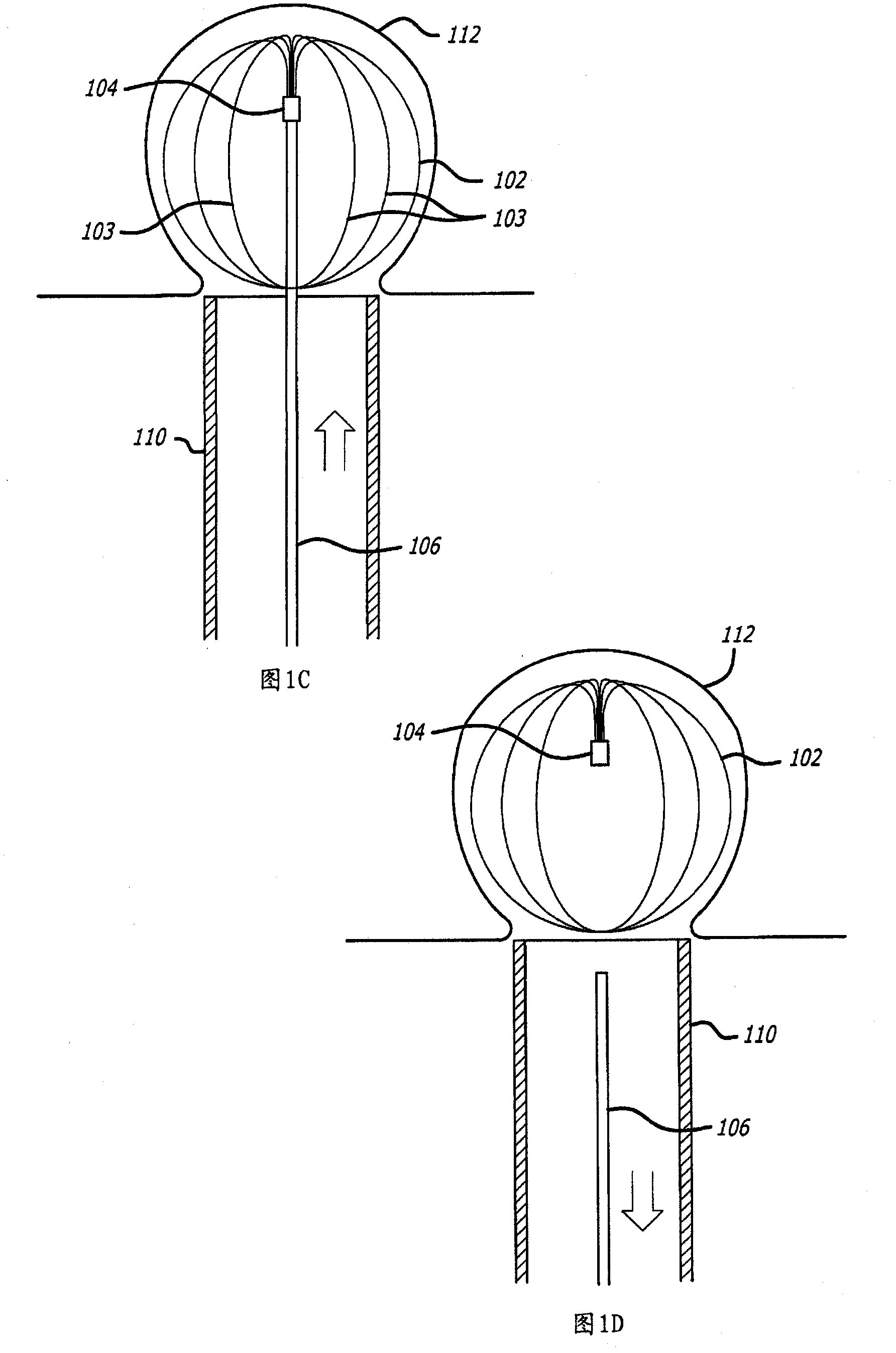 Self-expandable aneurysm filling device and system