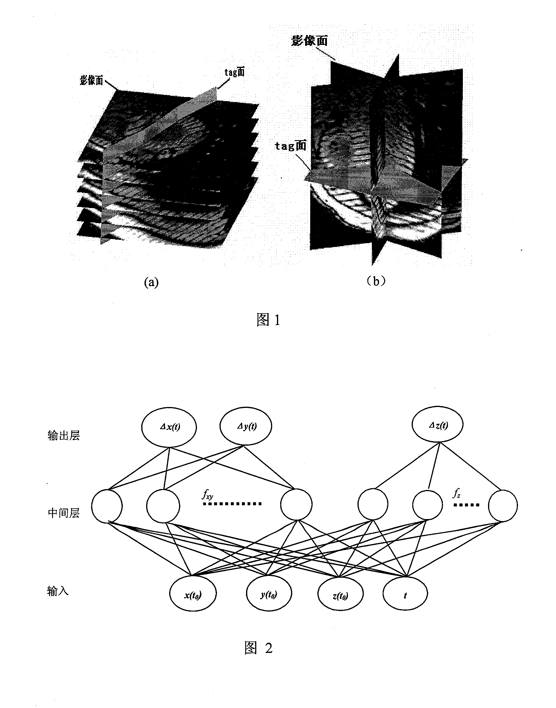 Three-dimension cardiac muscle straining computing method