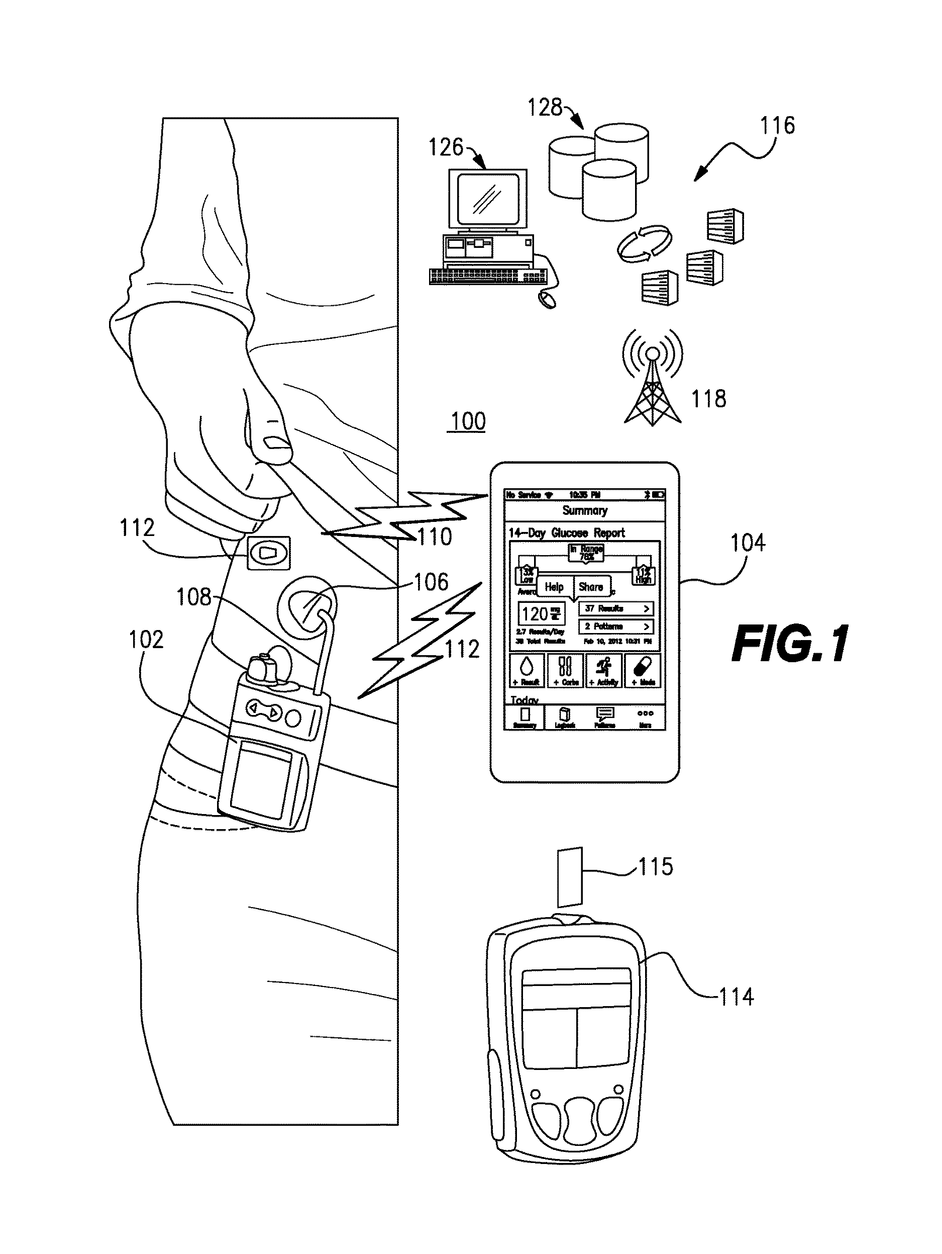 Method and system for closed-loop control of an artificial pancreas