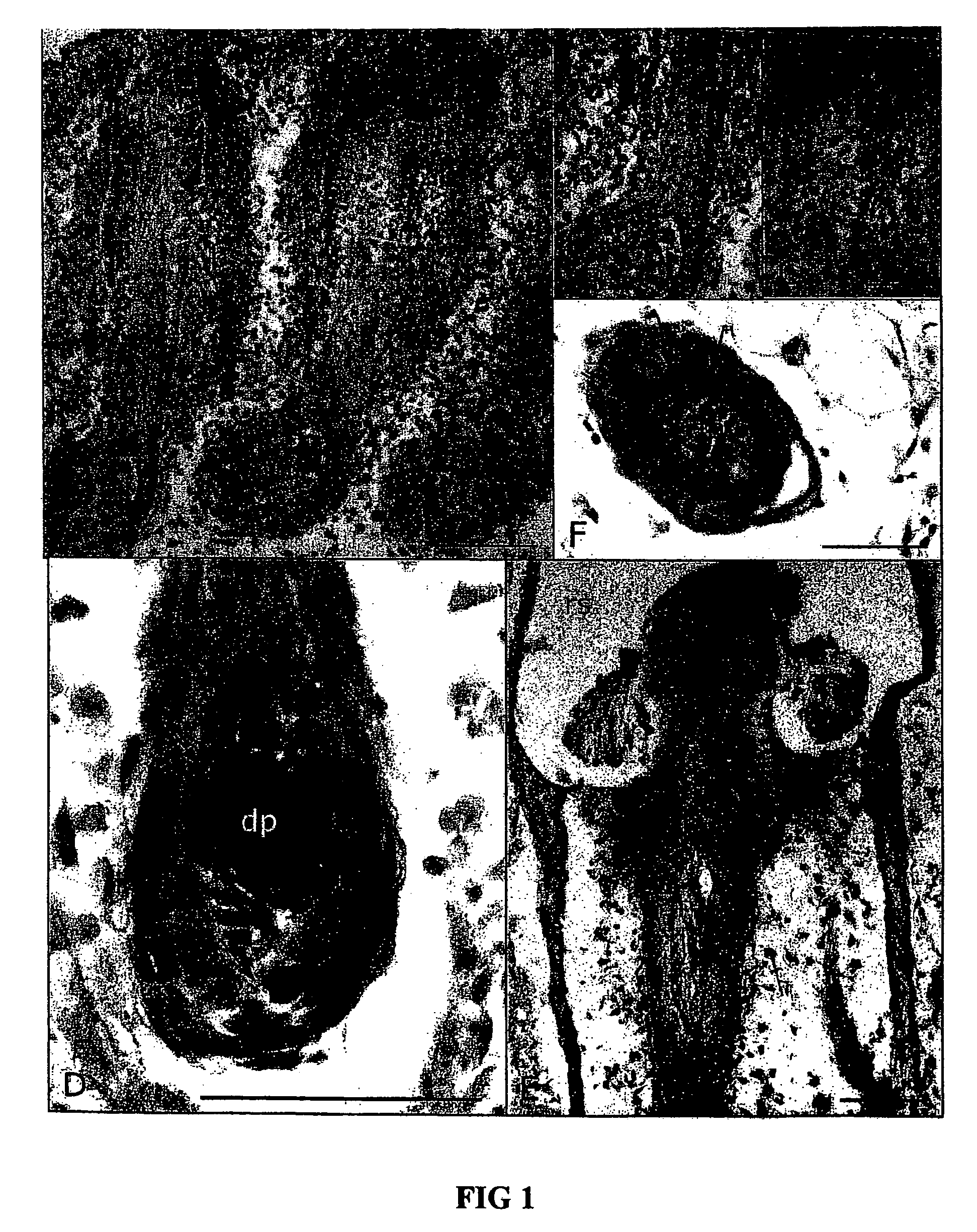 Method of isolating epidermal neural crest stem cells