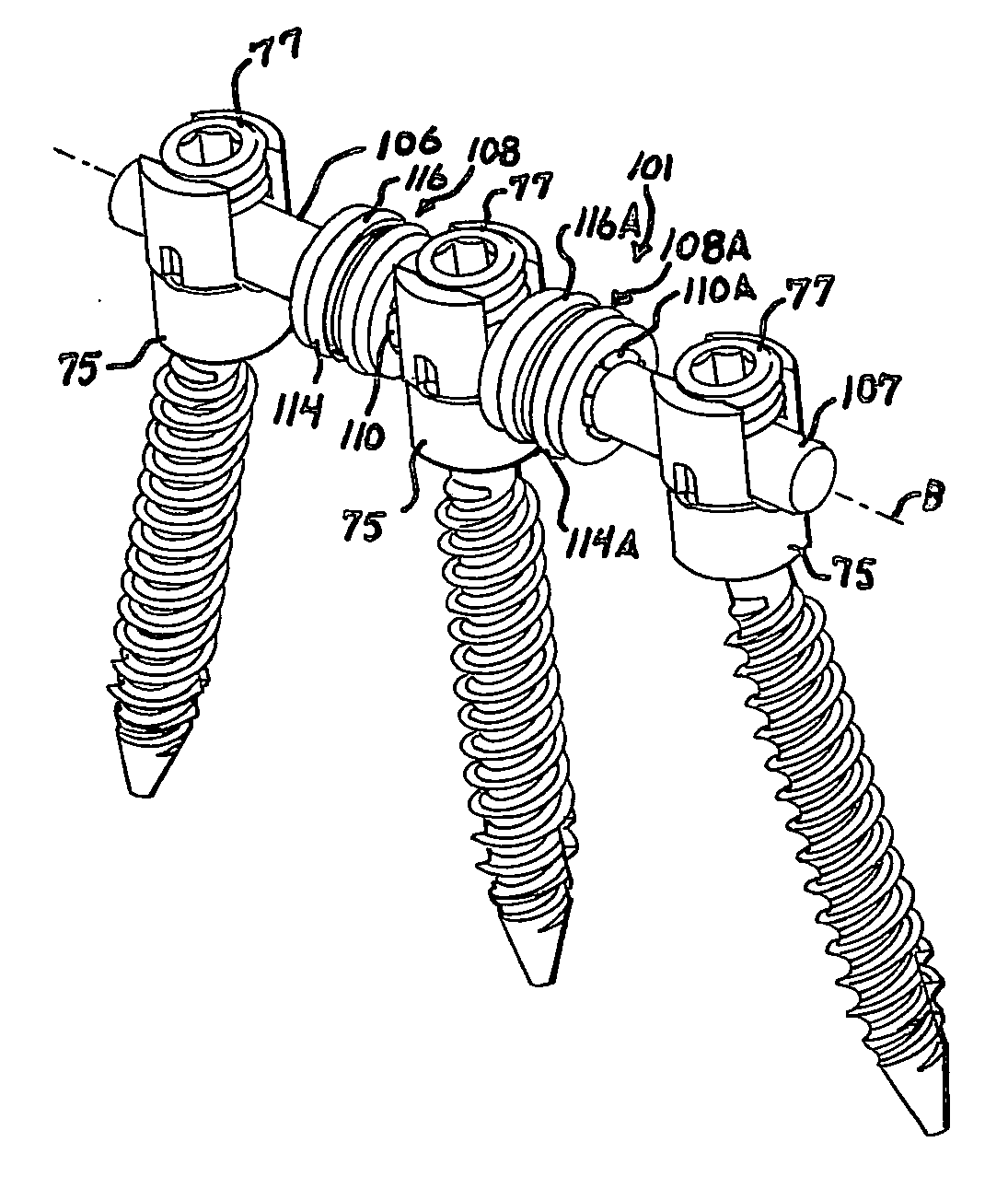 Soft stabilization assemblies with pretensioned cords