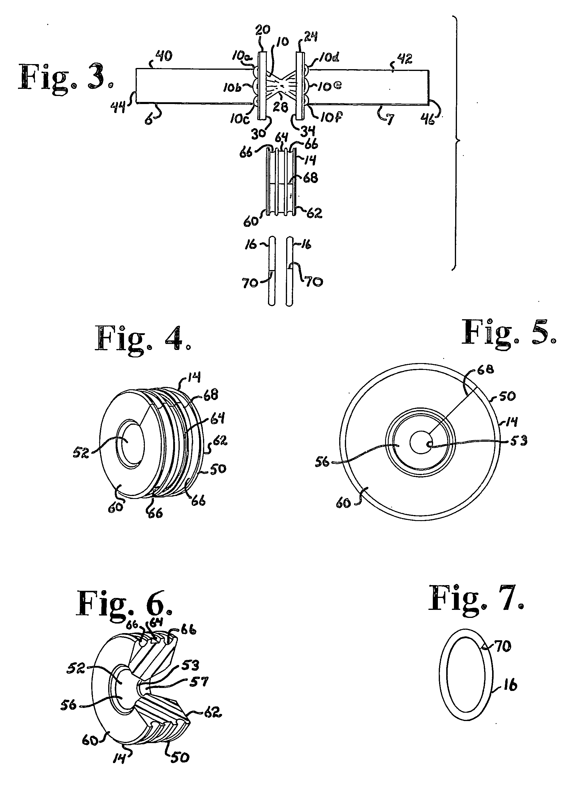 Soft stabilization assemblies with pretensioned cords