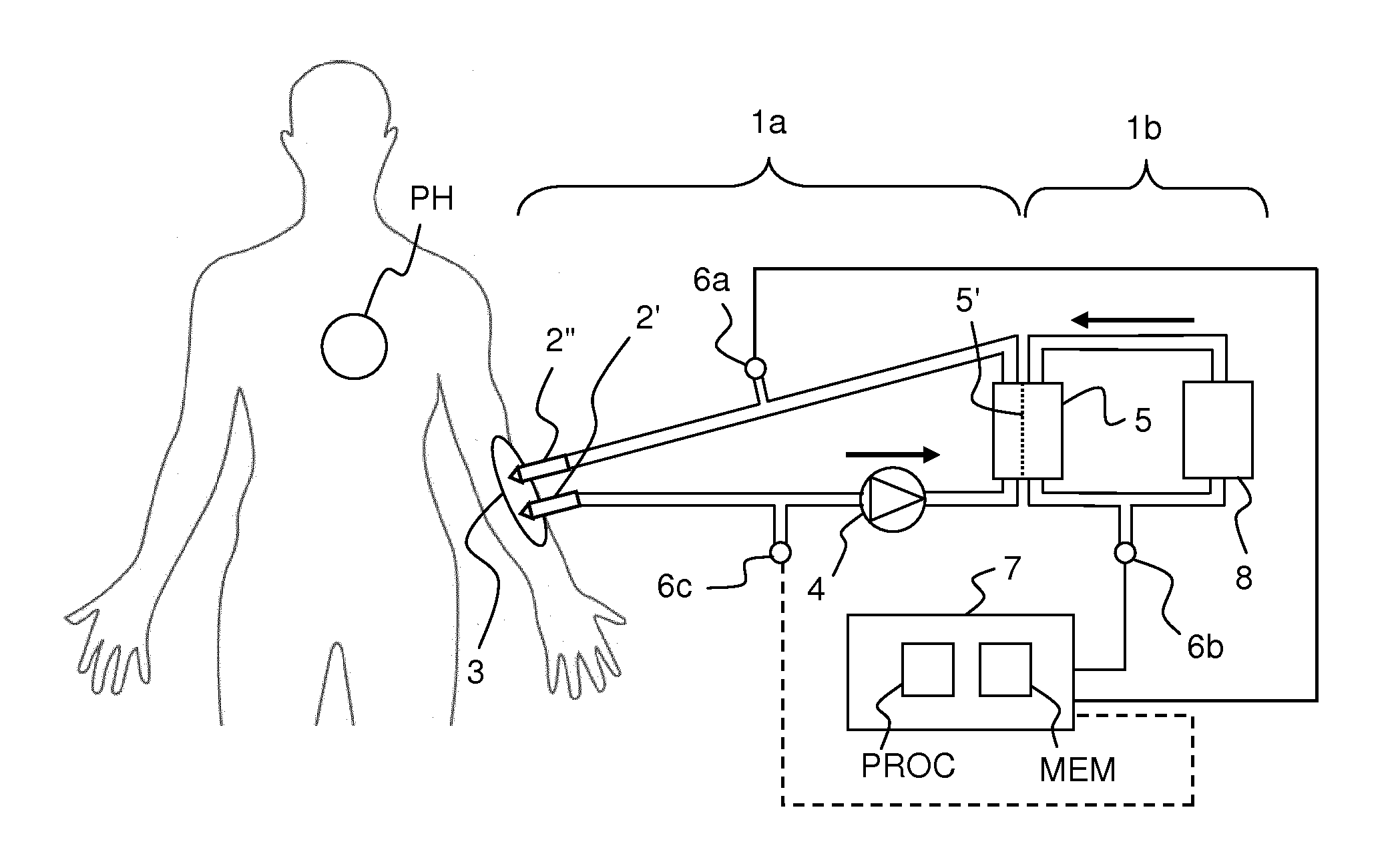 Detecting pressure pulses in a blood processing apparatus