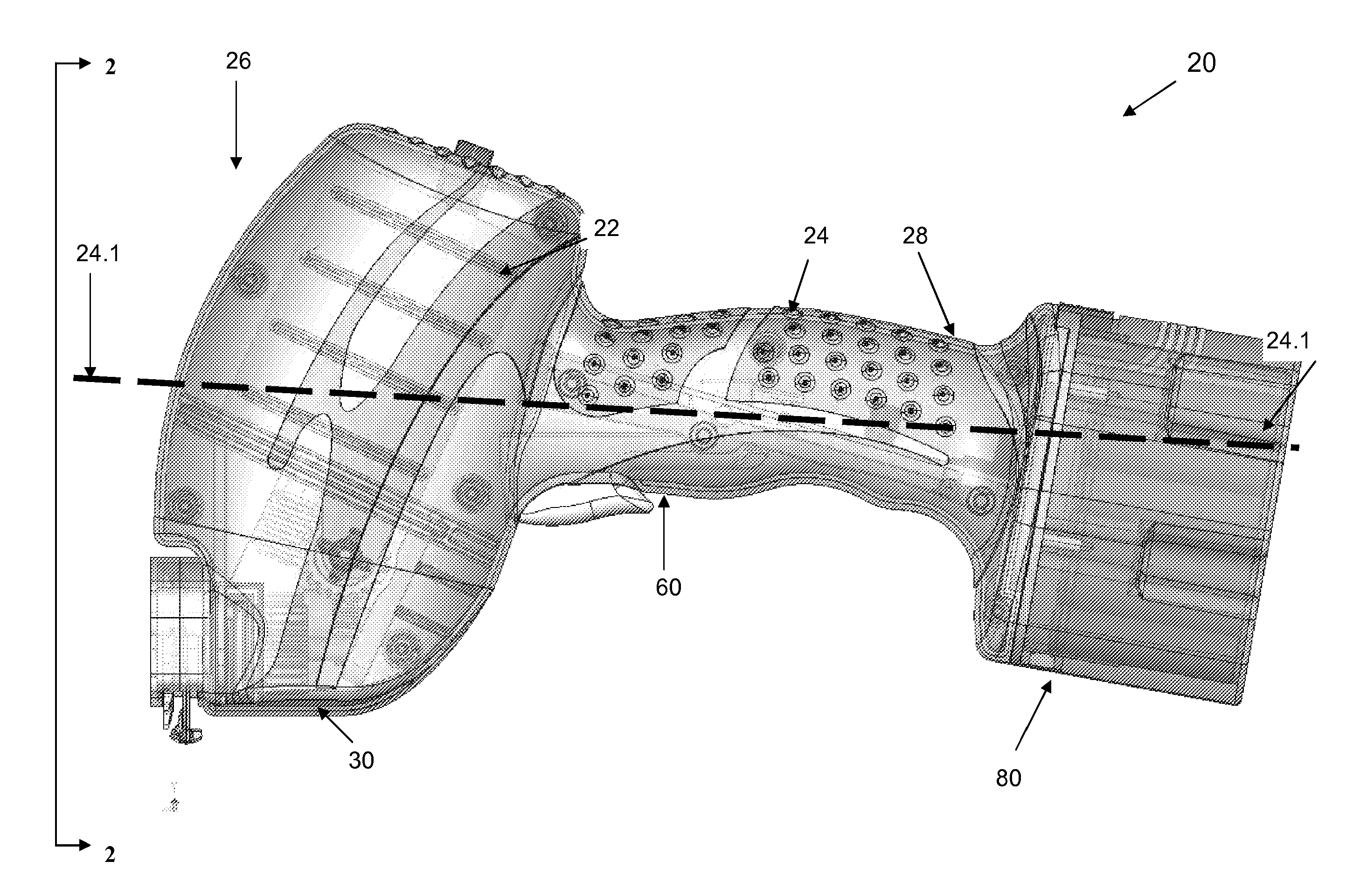 Cast removal system