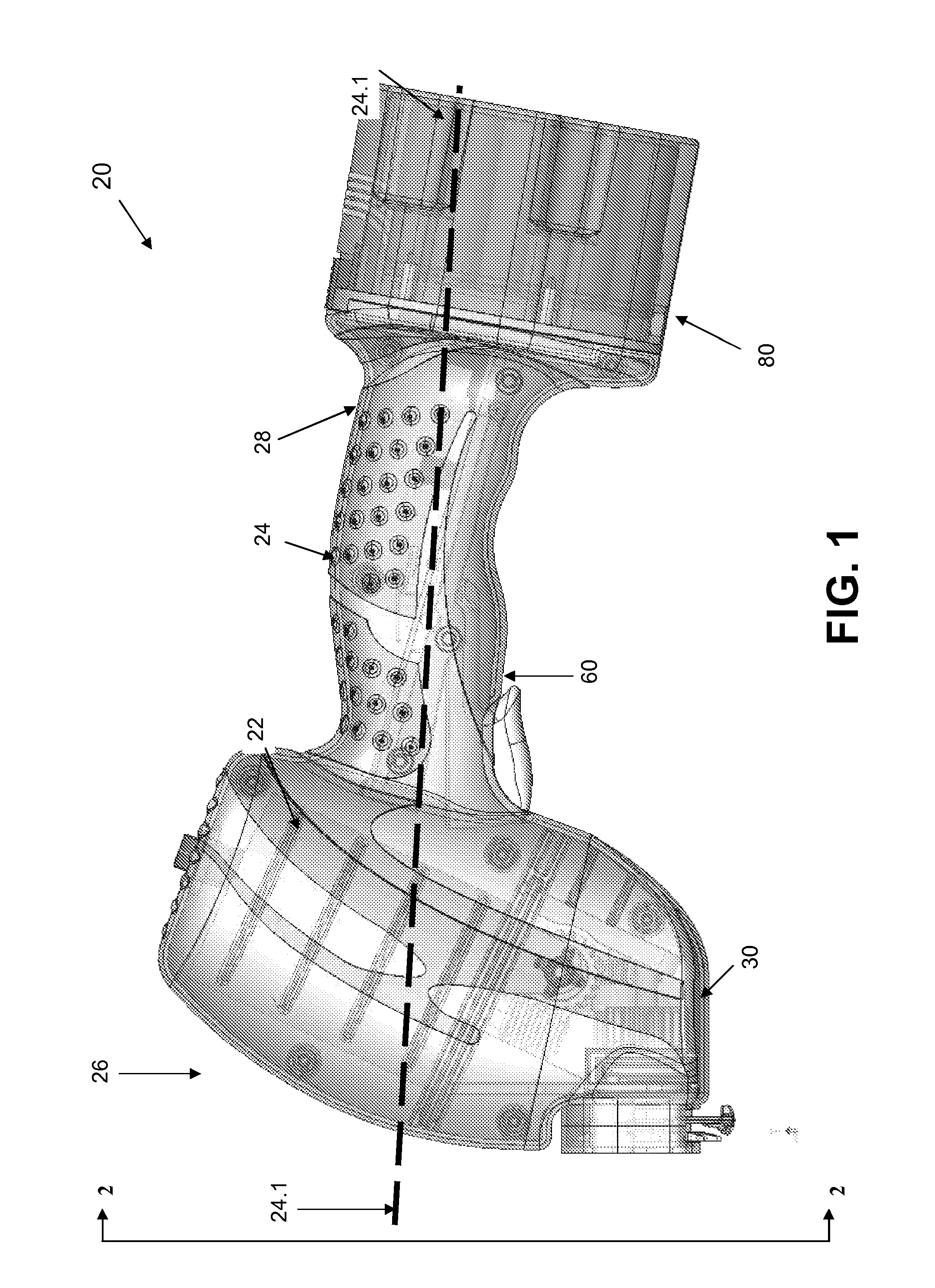 Cast removal system