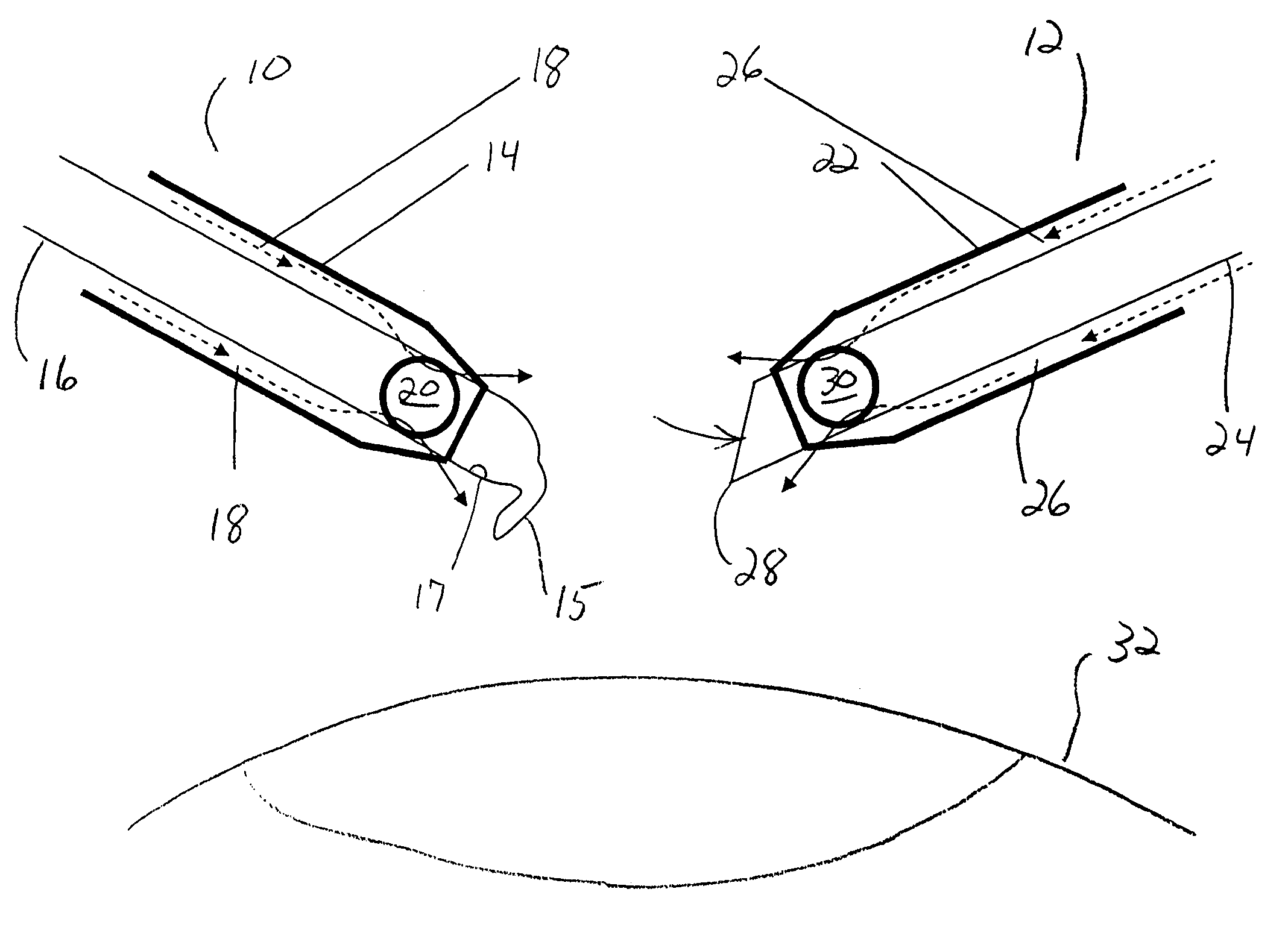 Surgical method and apparatus