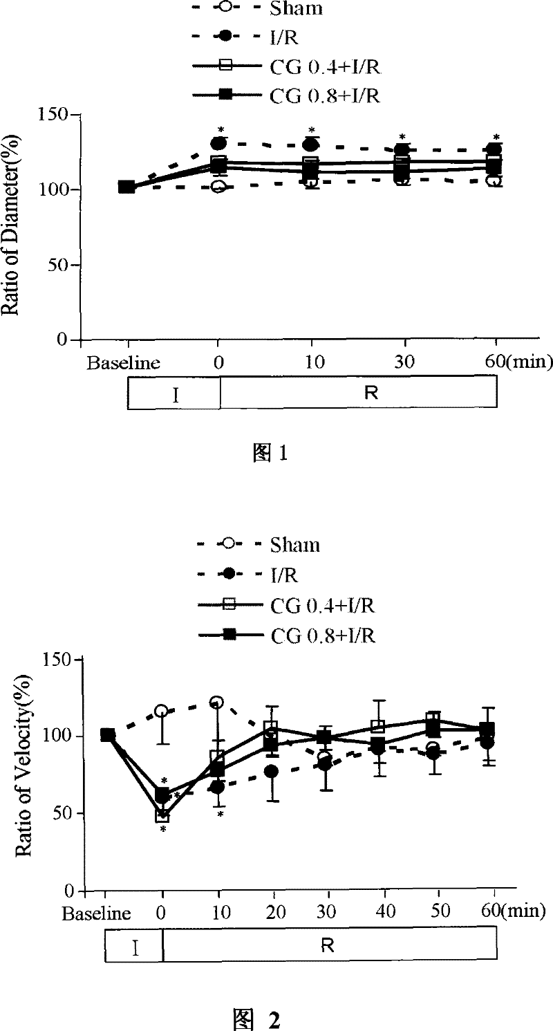 Uses of medicament composition in preparing medicament for improving brain microcirculation disorder