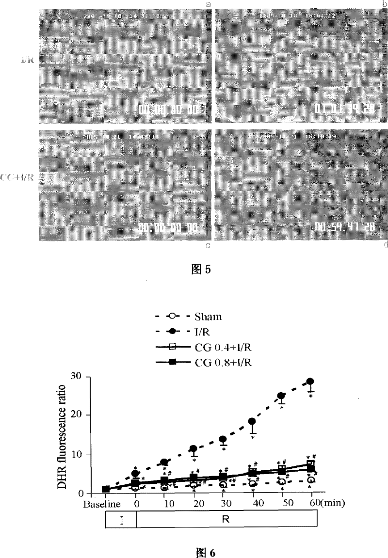 Uses of medicament composition in preparing medicament for improving brain microcirculation disorder