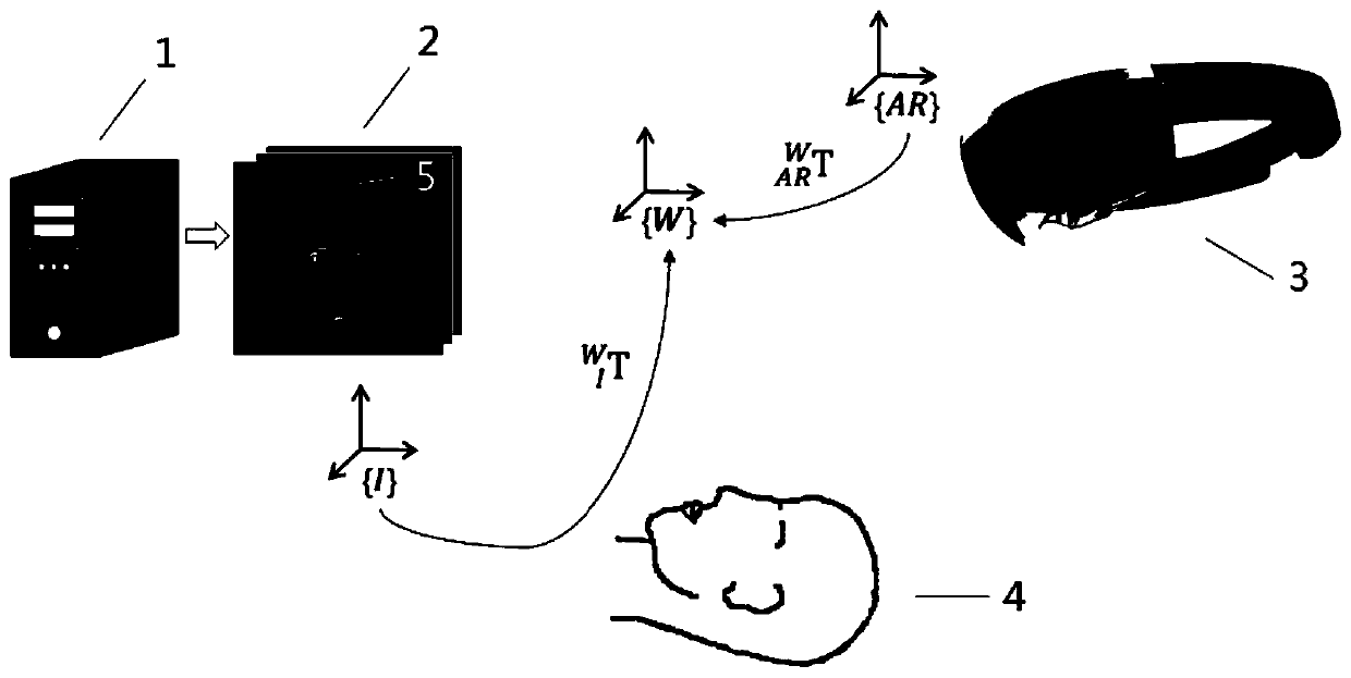 Neurosurgical navigation method and system based on augmented reality technology