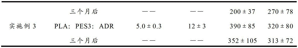 Toughened polylactic acid and preparation method of same