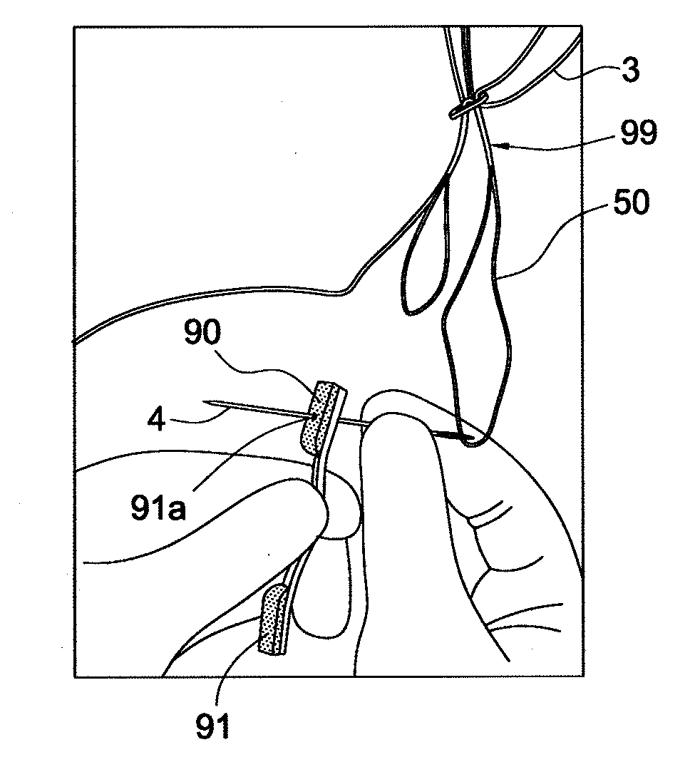 Adjustable self-locking loop constructs for tissue repairs and reconstructions