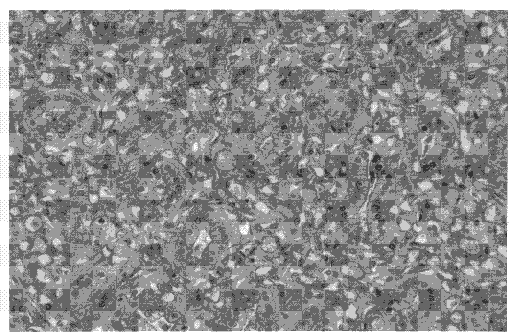 Formaldehyde-free fixative for tissue sample