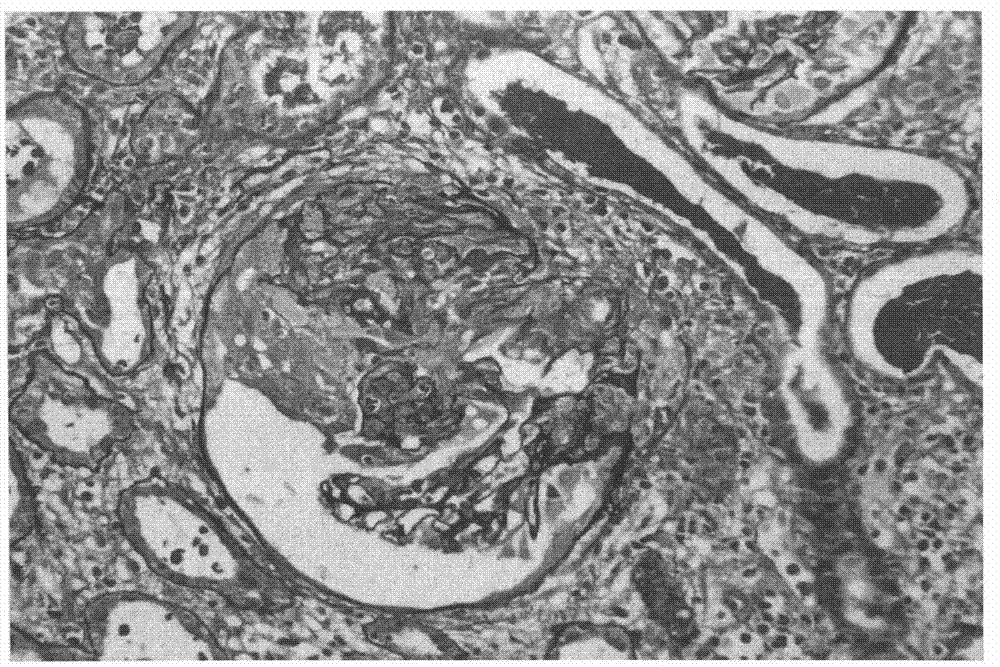 Formaldehyde-free fixative for tissue sample