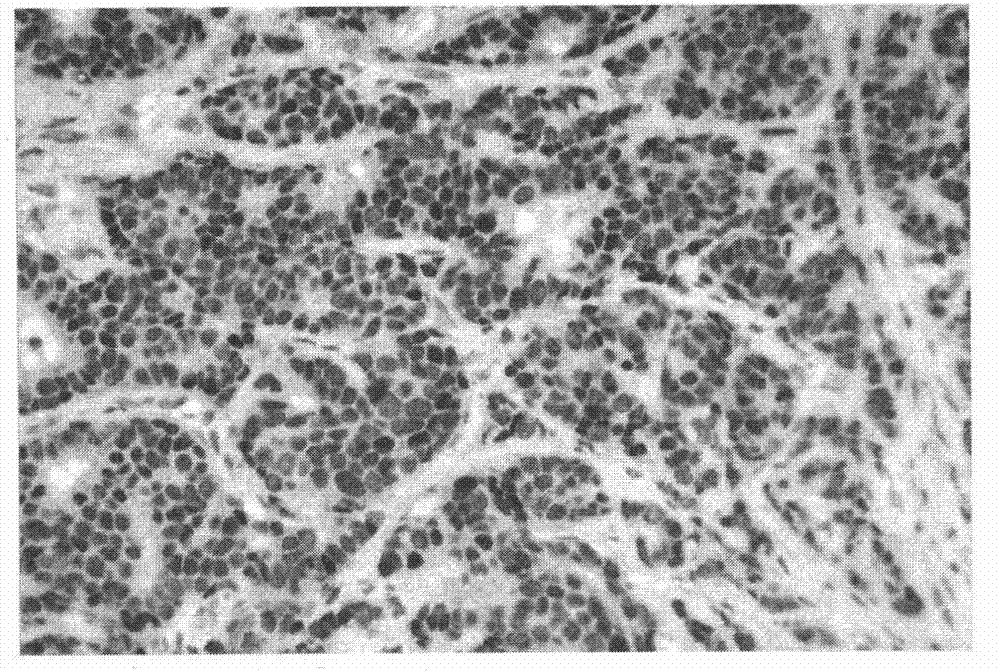 Formaldehyde-free fixative for tissue sample