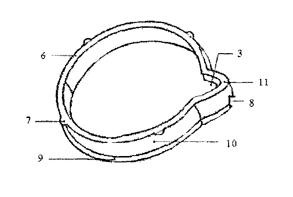 Chalaza protection parts of circumcision anastomats