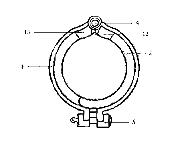 Chalaza protection parts of circumcision anastomats