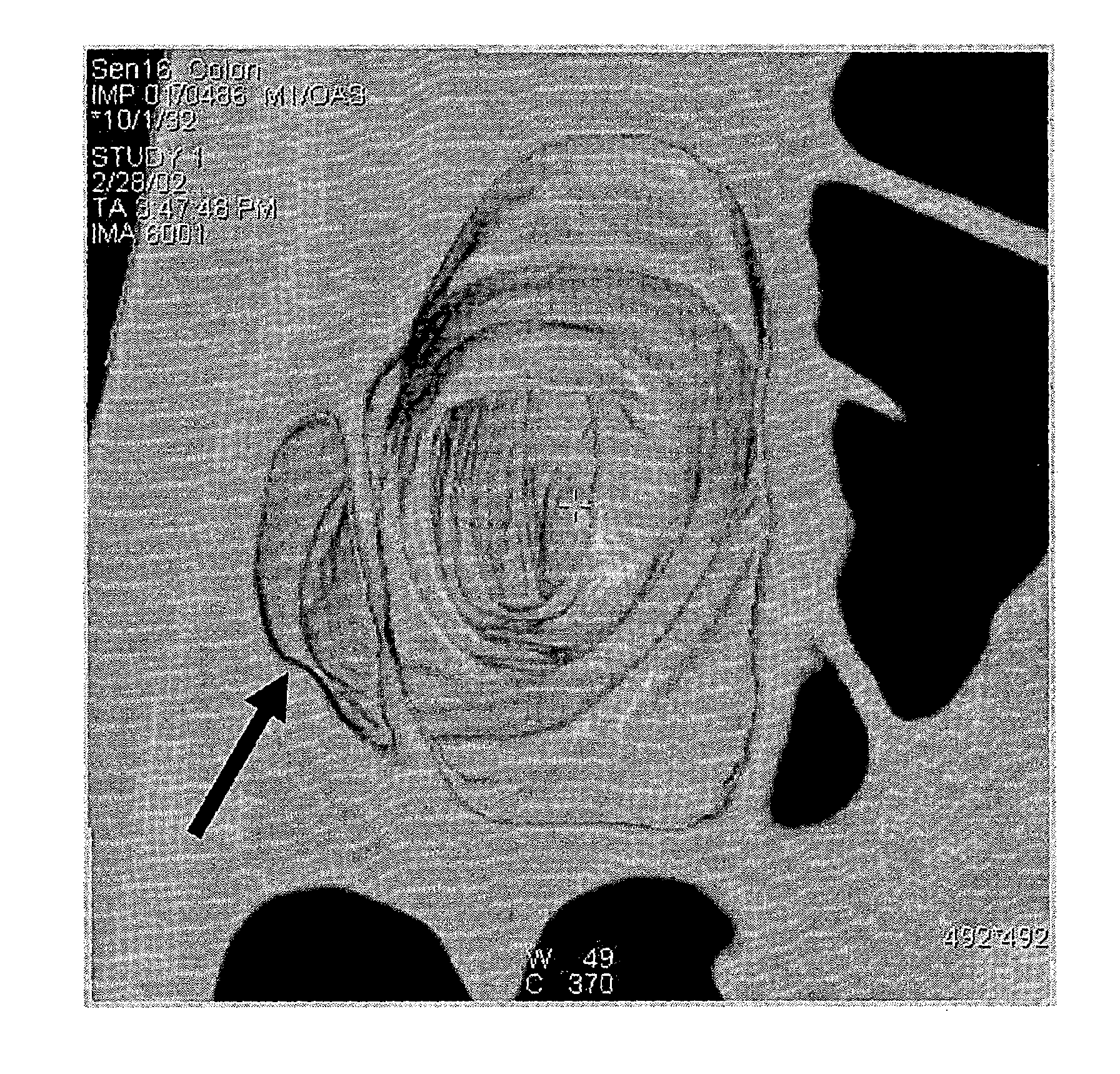 System and method for performing a virtual endoscopy