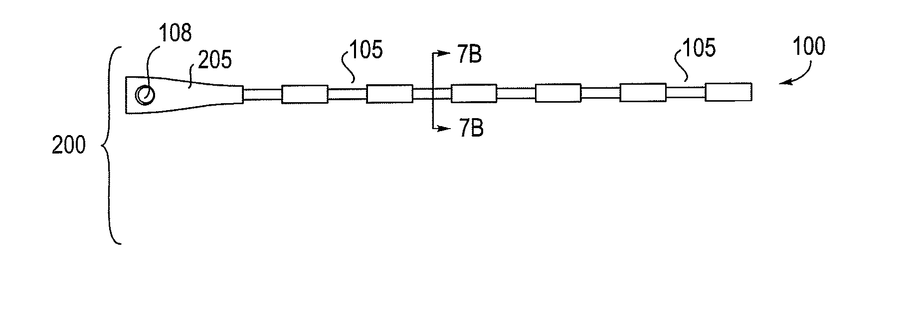 Partially erodable systems for treatment of obstructive sleep apnea