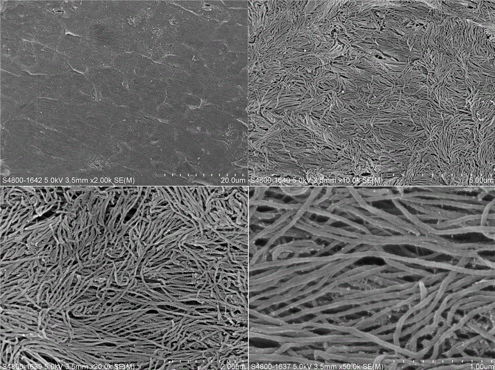 A method for making a guided tissue regeneration membrane with an absorbable antibacterial bone-like structure